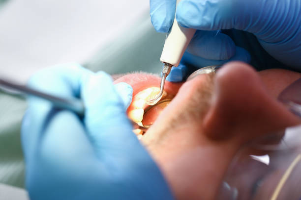  River Oaks, TX Emergency Dentist Pros