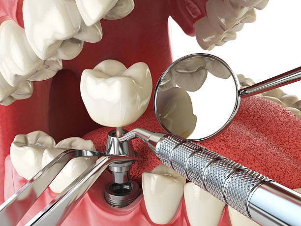 Best After-Hours Emergency Dentist in River Oaks, TX