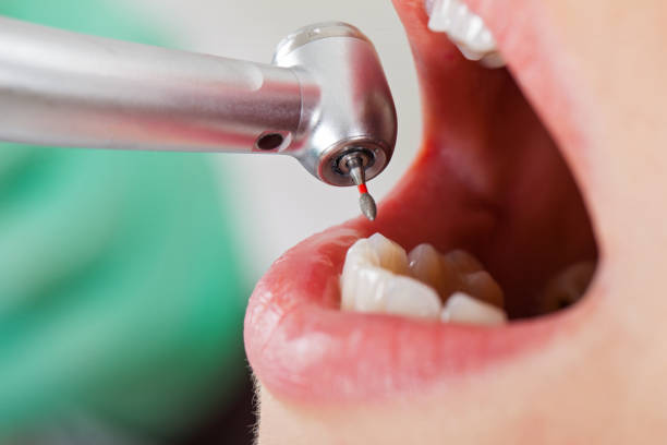Best Emergency Broken Tooth Repair in River Oaks, TX